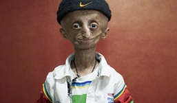 Chàng trai 15 tuổi phải sống trong thân thể của một cụ già