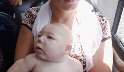 WHO ban bố tình trạng khẩn cấp toàn cầu về virus Zika gây teo não