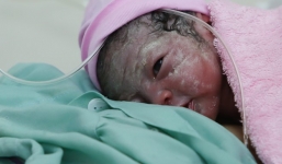 3 công dân nhí đầu tiên chào đời vào Tết Bính Thân 2016