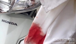 Truy tìm xe ô tô gây tai nạn bỏ trốn khỏi hiện trường