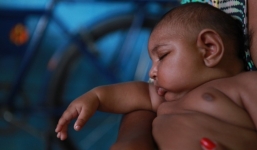 Virus Zika gây teo não không đáng sợ như bạn tưởng