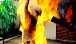 Hút thuốc khi đang đổ xăng, 3 người trong gia đình bỏng nặng