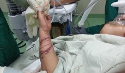  Bé trai 4 tuổi bị cá sấu cắn đứt gân tay ở Cà Mau