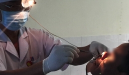 Đỉa dài 6cm sống trong mũi một người đàn ông