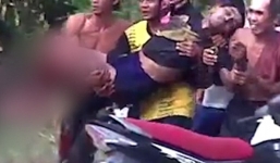 Khoảnh khắc người đàn ông bị cá sấu cắn mất chân