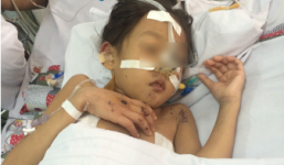 Giành giật sự sống cho bé gái dập não do tai nạn