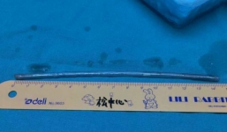 Giận vợ, người đàn ông nuốt cây đinh dài 15cm