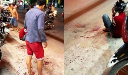 Trích xuất hình ảnh từ camera, bắt được kẻ chém lìa tay thanh niên