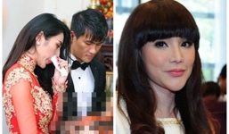 Sao Việt 'tụt dốc nhan sắc' do phẫu thuật thẩm mỹ