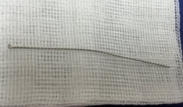 Hy hữu nam thanh niên nhập viện sau khi lấy ráy tai