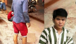 Bắt nghi can trực tiếp chém lìa tay nam thanh niên trên phố