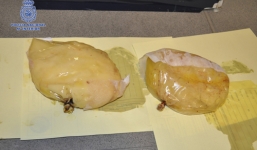 Nâng ngực bằng 1 kg cocain lỏng nhằm buôn lậu sang Đức