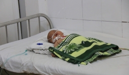 Bé trai 5 tháng tuổi nhiễm viêm não mô cầu