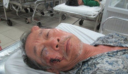 Cụ ông tật nguyền bị 3 thanh niên đánh đập, cướp 40 tờ vé số