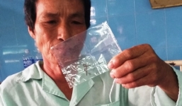 Nuốt phải dây đồng 4cm khi ăn cơm