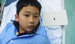 Đầu bút bi mắc trong phế quản bệnh nhi 7 tuổi