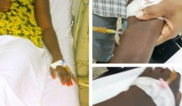 Ép eo quá nhỏ, nữ diễn viên phải nhập viện