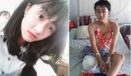 Câu hỏi của nữ sinh bị cưa chân khiến mẹ lặng người