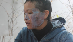 Bị chồng bạo hành dã man như thời trung cổ vì tham gia đa cấp?