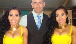 Chuyện tình chị em song sinh chi 5 tỷ phẫu thuật thẩm mỹ có chung bạn trai