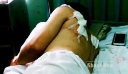 Chủ nhà hàng khu phố Tây bị đâm gục: 3 nghi phạm đầu thú