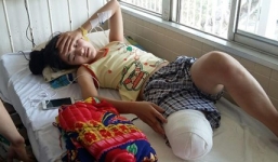 Vụ nữ sinh bị cưa chân: Gia đình yêu cầu xử lý hình sự bác sĩ tắc trách