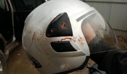 Hà Nội: Nhà báo bị 3 người lạ mặt đánh trọng thương