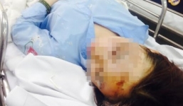 Nữ sinh bị tạt axit ở Sài Gòn có nguy cơ bị mù mắt trái