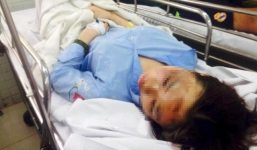 Nữ sinh bị tạt axit vẫn không hiểu vì sao bị tấn công dã man