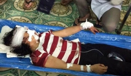 Hôm nay, xét xử vụ chồng bạo hành vợ ở Bắc Giang