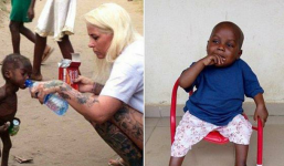 Cậu bé 'phù thủy' người Nigeria phục hồi đáng kinh ngạc