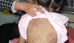 Mẹ kế đánh đập con riêng của chồng vì 1.000 đồng bị khởi tố