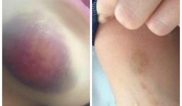 Thông tin thêm vụ thiếu nữ 18 tuối tố bị phụ xe buýt quấy rối tình dục