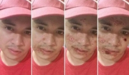 Ứng dụng Ice Effex cảnh báo hậu quả của ma túy đá