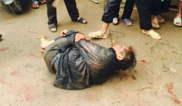 'Cẩu tặc' rút súng bắn trả người truy đuổi bị dân đánh trọng thương