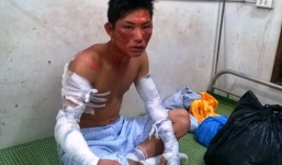 Nghệ An: Nổ lớn ở nhà máy chế biến tinh bột sắn, 4 người bị bỏng nặng