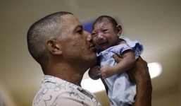 Bộ Y tế: Không phải cứ mang thai bị Zika sẽ sinh con đầu nhỏ