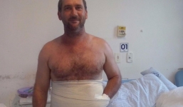 Phương pháp chữa bệnh độc đáo: 'Cất' tay trong ổ bụng