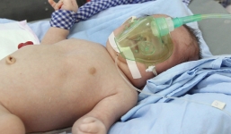 Bé sơ sinh không hậu môn, hở hàm ếch được cộng đồng mạng cưu mang