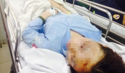 Nữ sinh bị tạt axít ở Sài Gòn chia sẻ cảm giác sau khi gặp nạn