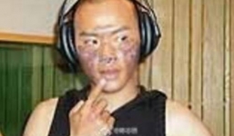 Nhĩ Thái 'Hoàn châu cách cách' tiết lộ gương mặt từng bị bỏng nặng