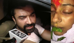 Sao Cô dâu 8 tuổi bị đánh bầm tím trước khi qua đời