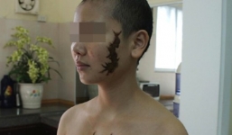 Tình yêu cổ tích của cô gái bị đánh ghen, xăm hình rết lên mặt