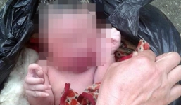 Bé trai sơ sinh nặng 3kg trong túi nilon trước cổng trạm y tế