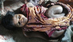 Cô gái 25 tuổi chỉ cao 70cm