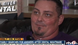 'Bay' cả hàm vì bốn chiếc răng sâu