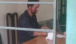 Khởi tố thanh niên ngoại quốc làm loạn trên phố Bồ Đề