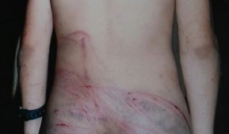 Để dê vào vườn hàng xóm, bé trai bị bố đánh tím người