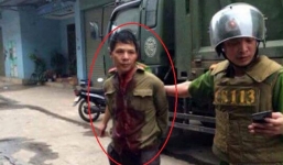 Vụ chém lìa tay chị gái: Người anh rể đã tử vong