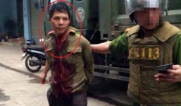 Chém lìa tay chị gái: Giám định tâm thần bị can